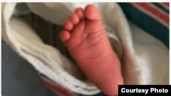 Dalam kurun waktu dua tahun, sedikitnya ada enam bayi yang terlahir tidak normal di Mandailing Natal. Bayi-bayi itu diduga terpapar zat kimia berbahaya seperti merkuri pada saat masih janin. (Foto: ilustrasi).
