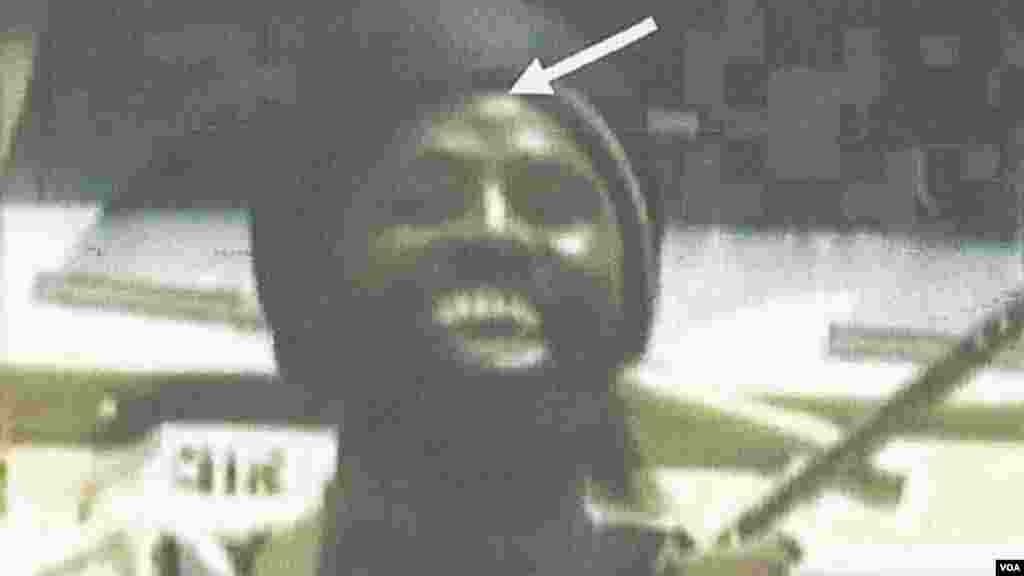 Detail of photo showing a unique facial mark indicating the identity of the body as the same person appearing in several Boko Haram videos.