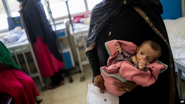 Seorang Ibu menggendong bayi putrinya, Samina (5 bulan) yang menderita malnutrisi akut di rumah sakit Kabul, Afghanistan. 