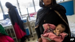 Seorang perempuan Afghanistan menggendong putrinya yang berusia lima bulan, Samina, di bangsal pasien dengan gizi buruk Rumah Sakit Anak Indira Gandhi, di Kabul, Afghanistan, Rabu, 15 September 2021. (AP Photo/Bernat Armangue)