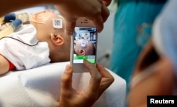 FILE - A doctor uses a smartphone to take a photo of a child with facial deformity before surgery at the Vietnam Cuba hospital in Hanoi, Nov. 18, 2014.