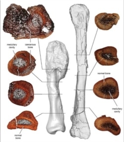 A comparison between thin sections of the cancerous leg bone (L) and a normal fibula bone of the horned Centrosaurus is seen in this image released on August 3, 2020.