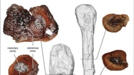 A comparison between thin sections of the cancerous leg bone (L) and a normal fibula bone of the horned Centrosaurus is seen in this image released on August 3, 2020.