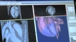 3D Printers Help Heart Surgeons