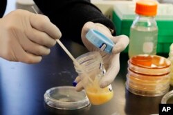 Yale University researcher Benjamin Chan, who studies viruses that attack bacteria, prepares a petri dish with mucus from patient Ella Balasa, of Richmond, Va., at Osborn Memorial Laboratories, in New Haven, Conn., Jan. 17, 2019.