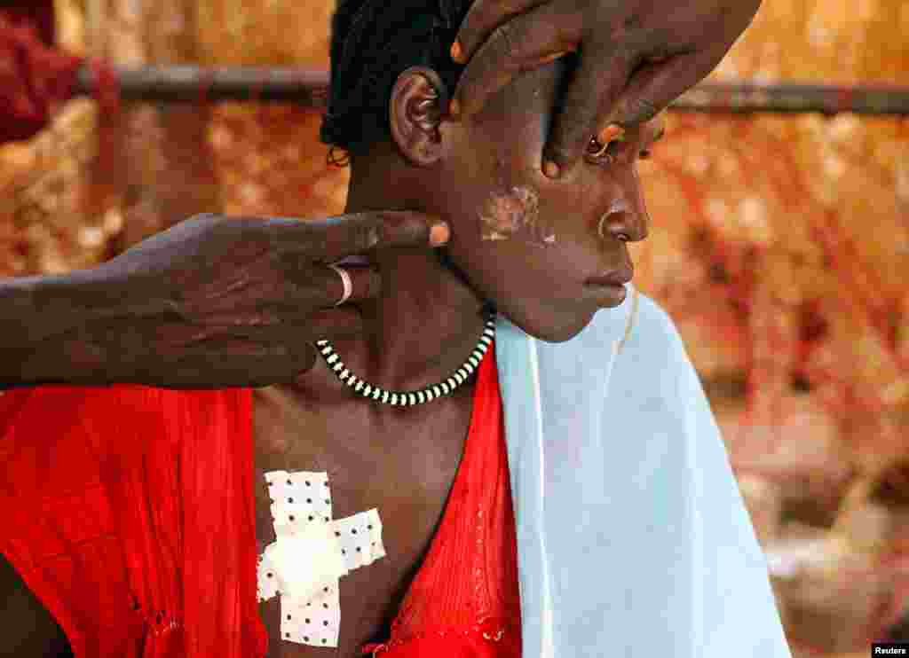 Seorang perempuan dari suku Nuba mendapatkan perawatan untuk luka yang diakibatkan serangan angkatan udara Sudan, di rumah sakit darurat di Kordofan Selatan, Sudan (28/4).