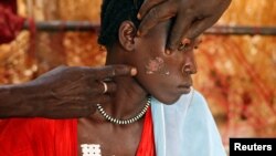 A Nuba woman, injured during a raid by Sudan's air force, sits in a makeshift hospital in South Kordofan in April 2012. 