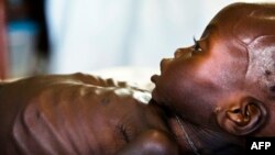 Agop Manut, 11 mois, souffre de malnutrition aiguë et de détresse respiratoire, à la clinique de médecins sans frontières (MSF) où il est soigné, à Aweil, dans le nord du Bahr al Ghazal, Soudan du Sud, 11 octobre 2016