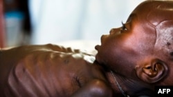 Agop Manut (11 bulan), yang menderita malnutrisi akut dirawat di klinik Dokter Tanpa Tapal Batas di Bahr al Ghazal, Sudan Selatan (foto: ilustrasi). 