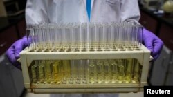 FILE - An employee carries test tubes inside a laboratory in India, Aug. 11, 2014.
