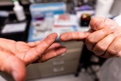 Fingertip-sized patches with dissolvable microscopic needles, a potential COVID-19 vaccine, are seen at the University of Pittsburgh, Pittsburgh, Pennsylvania.