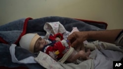 Four-month-old Mohammed who is malnourished lays on a hospital bed in the Indira Gandhi hospital in Kabul, Afghanistan, Nov. 8, 2021. 