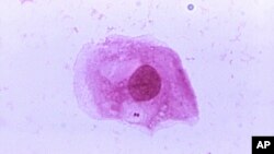 This image provided by the Centers for Disease Control and Prevention shows a photomicrograph of Neisseria meningitidis. A contagious bacterial infection appears to be the cause of at least some cases in a mysterious outbreak in Liberia, U.S. health officials said on May 8, 2017.