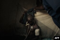 FILE—A wounded pro-government militiaman undresses in a hospital in Kanyabayonga, southern Lubero territory, North Kivu province, eastern Democratic Republic of Congo, on May 4, 2024.