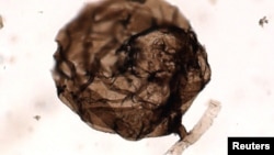 A multicellular fungus named Ourasphaira giraldae, which lived roughly 900 million to 1 billion years ago. is shown in this photograph from the University of Liege, Belgium released May 22, 2019. 