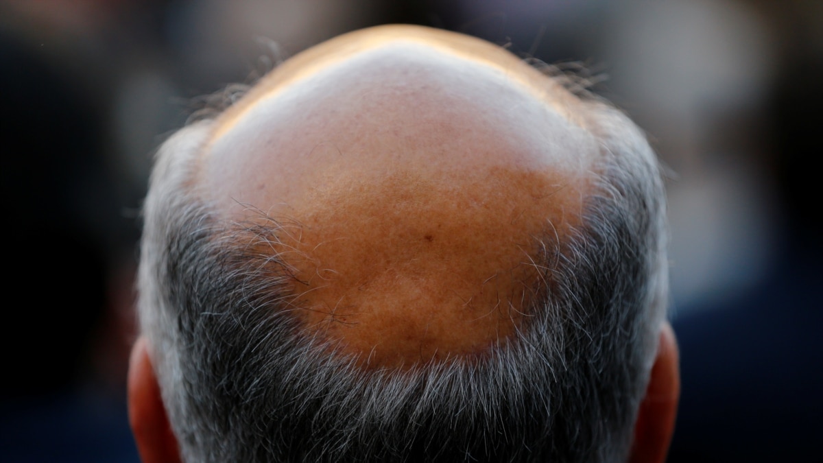 Early balding hotsell