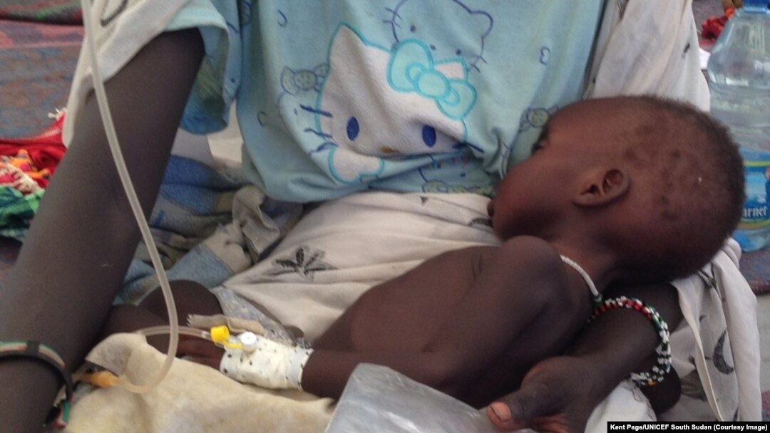 Trẻ em nhiễm vi khuẩn bệnh tả được điều trị tại Nam Sudan. 