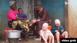 Warga penderita Albino di Malawi (foto: dok). 