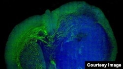 Gambaran dari tumor otak glioblastoma manusia pada otak seekor tikus yang dihasilkan dengan menggunakan teknik yang disebut Stimulated Raman Scattering (SRS). Teknik ini memungkinkan melihat perbedaan antara jaringan tumor (warna biru) dengan jaringan normal (warna hijau) berdasarkan pada sinyal-sinyal lemah yang dipancarkan oleh jaringan dengan struktur sel yang berbeda.