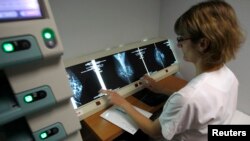 FILE - A radiologist examines breast X-rays after a medical check-up at the Ambroise Pare hospital in Marseille, southern France, April 3, 2008.