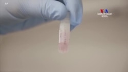 ԲԱՐԻ ԼՈՒՅՍ. Արամ Ավետիսյան՝ Վերարտադրողական բժշկության ոլորտի մասին