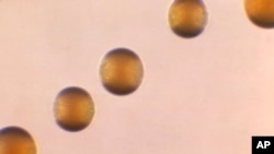 FILE - This 1966 microscope photo shows five colonies of Group-B Neisseria meningitidis bacteria. (Dr. Brodsky/CDC via AP)