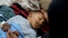 سازمان ملل شیوع وبا در سوریه را تهدیدی برای منطقه دانست