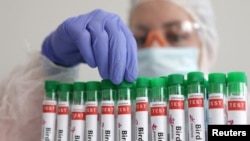 A person touches a test tube labelled "Bird Flu" in this picture illustration, from January 14, 2023. (Dado Ruvic/Reuters)