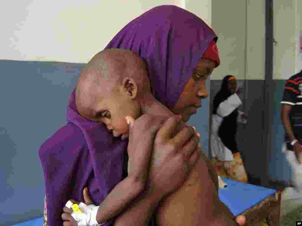 Luul Ibrahim, waa gabadh 2 sanno jir ah oo nafaqo-daro hayso, waxaana kor u haysa hooyadeed oo kula jirta Cisbitaalka Muqdisho