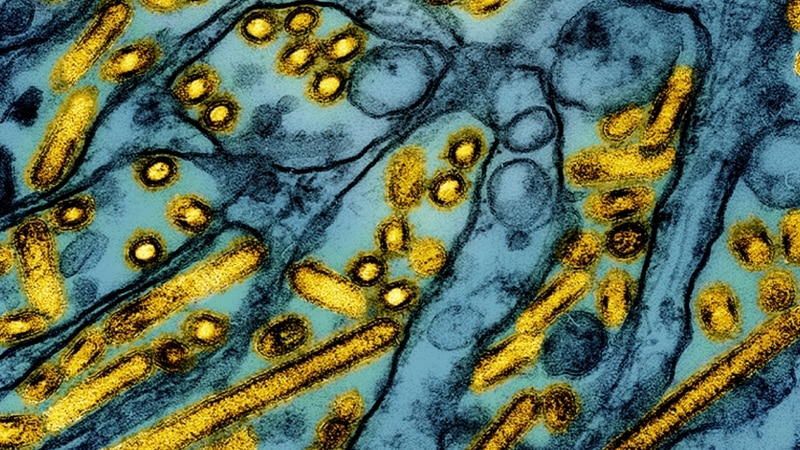 Louisiana reports 1st bird flu-related death in US, state agency says