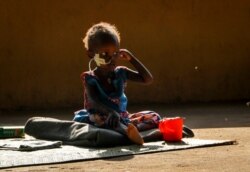 FILE - Akon Morro, 2, who is anemic and suffers from edema due to malnutrition, sits on the floor of a feeding center in Al Sabah Children's Hospital in Juba, South Sudan, Dec. 3, 2020.