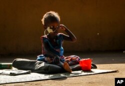 FILE - Akon Morro, 2, who is anemic and suffers from edema due to malnutrition, sits on the floor of a feeding center in Al Sabah Children's Hospital in Juba, South Sudan, Dec. 3, 2020.
