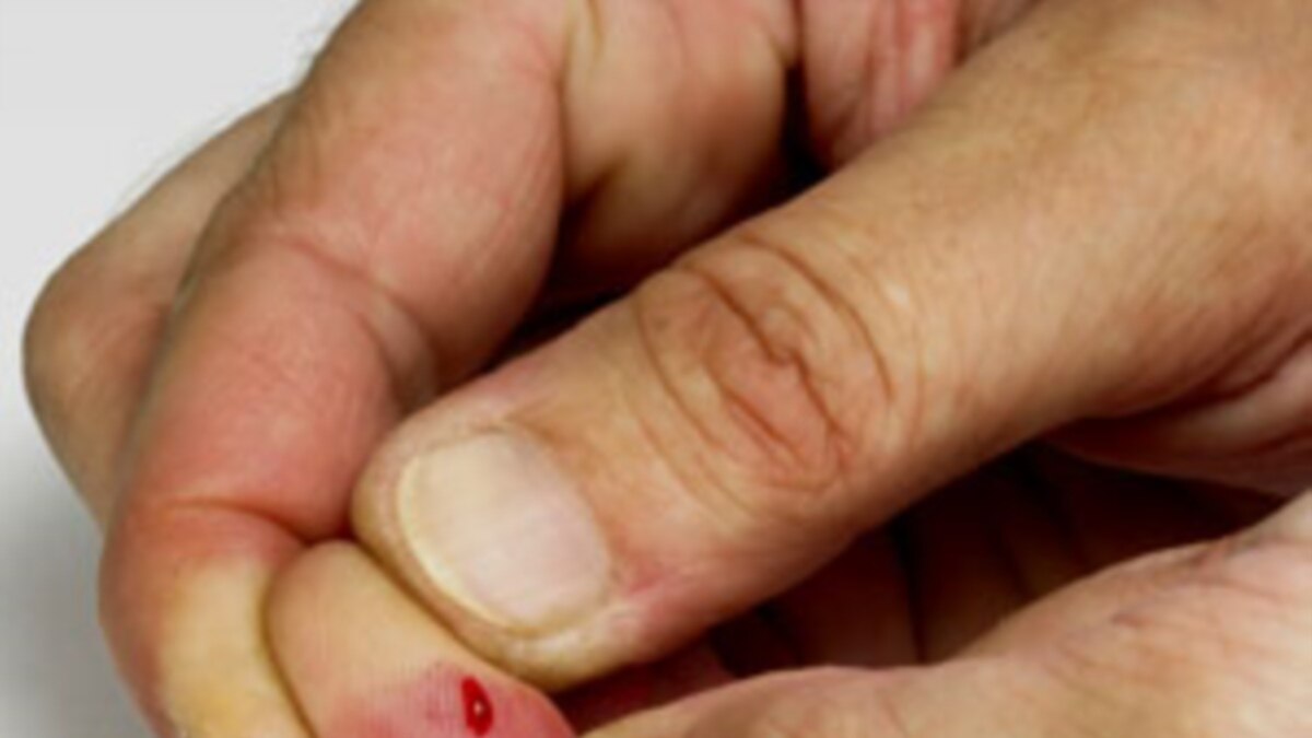 james staples cut fingers maine
