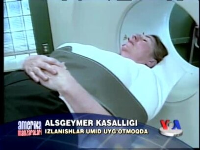 Alsgeymer qanday kasallik? Hope for Alzheimers
