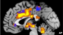 Para peneliti melaporkan bahwa mereka mampu menghilangkan perilaku kecanduan narkoba pada tikus yang kecanduan kokain dengan merangsang bagian otak yang disebut korteks prefrontal dengan sinar laser. Mereka juga mendapati bahwa efek itu bisa dibalikkan, mengubah tikus menjadi kecanduan kokain (foto: Dok).