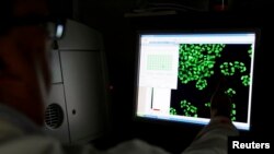 FILE - Scientist Paul Clarke looks at a picture of labeled cells on a monitor at the Institute of Cancer Research in Sutton, Britain.