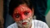အိန္ဒိယမှာ HIV ပိုးထိန်းဆေး ပြတ်လပ်မှု လူနာတွေဆန္ဒပြ
