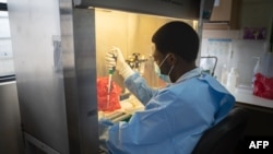 FILE - A laboratory technician processes samples for testing the COVID-19, novel coronavirus, at the Rwanda Biomedical Center (RBC) in Kigali, July 11, 2020.