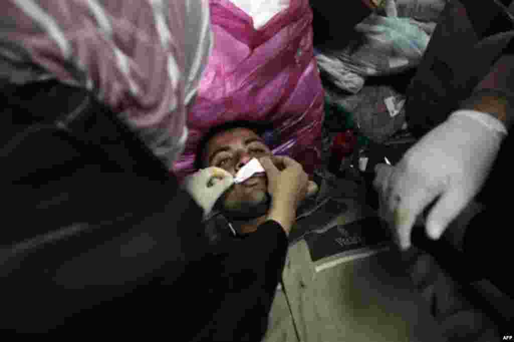 An anti-government demonstrator, wounded during clashes with pro-government protesters, is treated at a makeshift medical triage station, near Tahrir square, the center of anti-government demonstrations, in Cairo, Egypt, on Wednesday, Feb. 2, 2011. Thousa