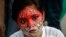 India World AIDS Day