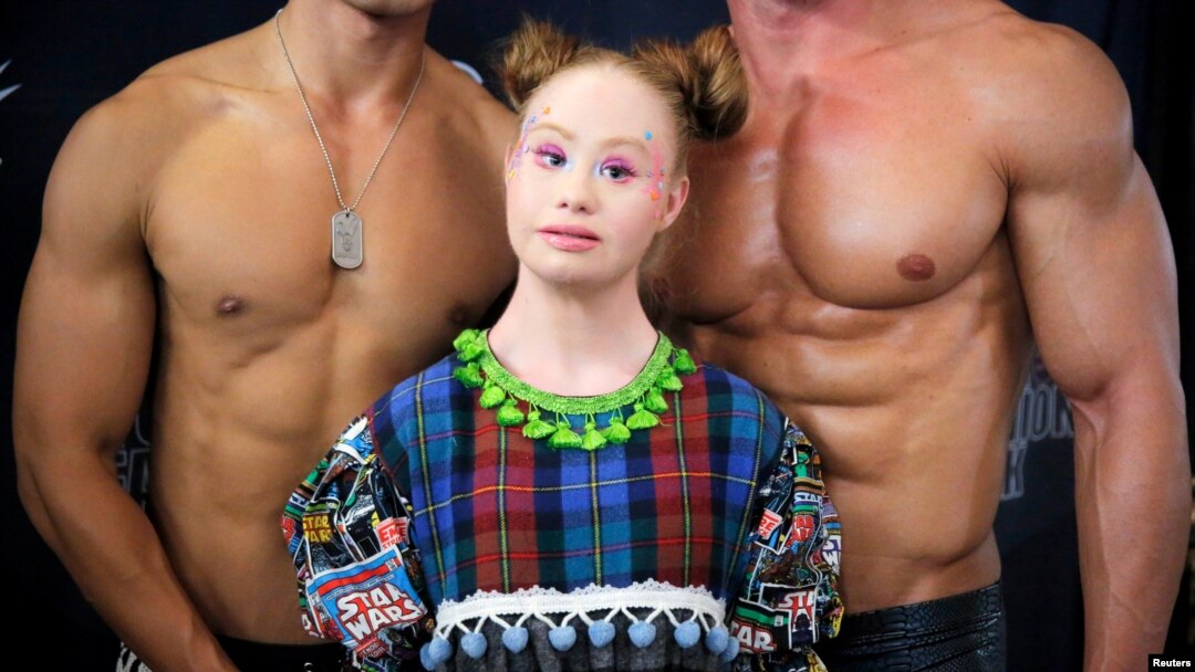 Madeline Stuart berdiri di belakang panggung dan berpose di antara dua model pria dalam Pekan Mode New York, di New York, 6 September 2018.