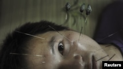 A patient suffering from facial paralysis undergoes acupuncture treatment at a traditional Chinese medical hospital in Jiaxing, Zhejiang province, July 11, 2012.