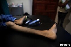 FILE - The leg of malnourished Ghazi Ahmad, 10, is pictured as he lies on a stretcher at a hospital in Taiz, Yemen, Nov. 3, 2018.