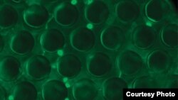 CD4 cells (bright green) are captured in between posts in an anti-CD4 capture chamber, which is part of the newly developed lab-on-a-chip. (Science Translational Medicine/AAAS)