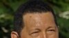 چاوز با پايان پرتودرمانی از کوبا به ونزوئلا بازگشت