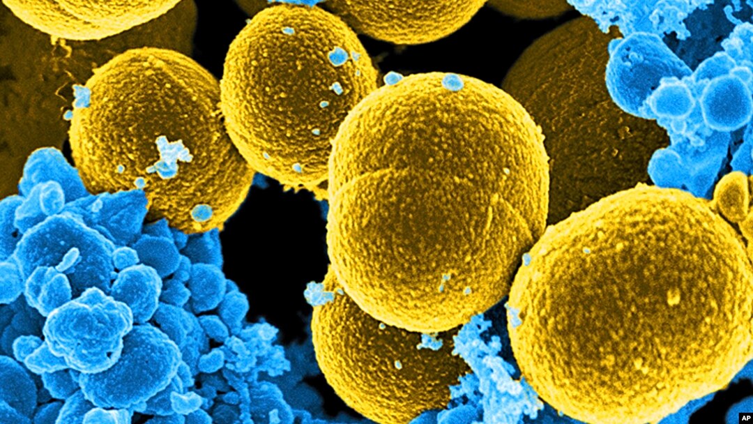 This digitally colorized microscope image provided by the National Institute of Allergy and Infectious Diseases (NIAID) shows Staphylococcus aureus bacteria in yellow. 