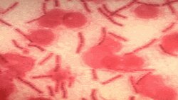 বাংলাদেশে অ্যানথ্রাক্স সংক্রমন পরিস্থিতির উন্নতির কারনে রেড এলার্ট প্রত্যাহার