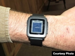 Tyler Skluzacek shows the myBivy smartphone/smartwatch application that helps military veterans suffering from PTSD sleep better at night. (Courtesy photo / T. Skluzacek)