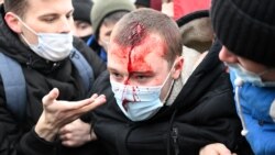 အတိုက်အခံ ဆန္ဒပြသမားတွေ ဖမ်းဆီးတဲ့ ရုရှားကို အရေးယူဒဏ်ခတ်ဖို့ ပြင်သစ် တိုက်တွန်း
