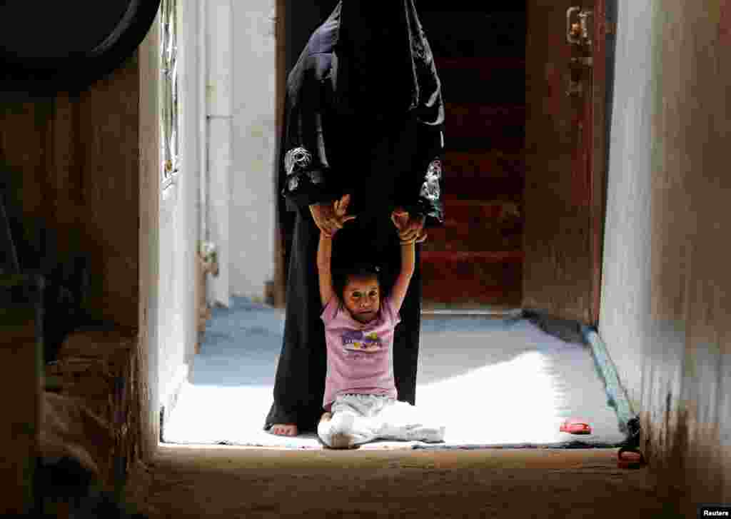 예멘 수도 사나에서 소녀가 집집마다시행되는 콜레라 예방 접종을 거부하고 있다.